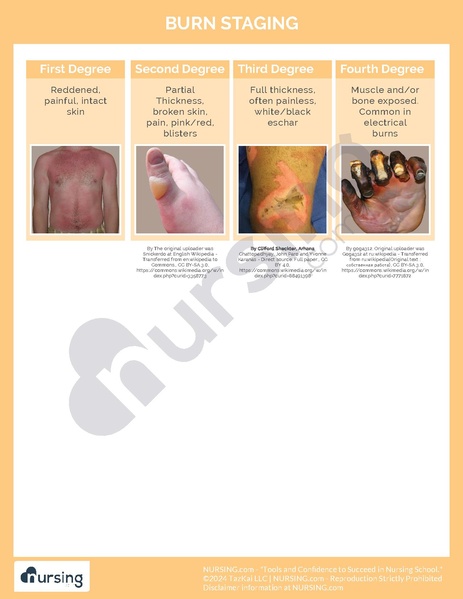 File:Burn Staging Cheatsheet.pdf