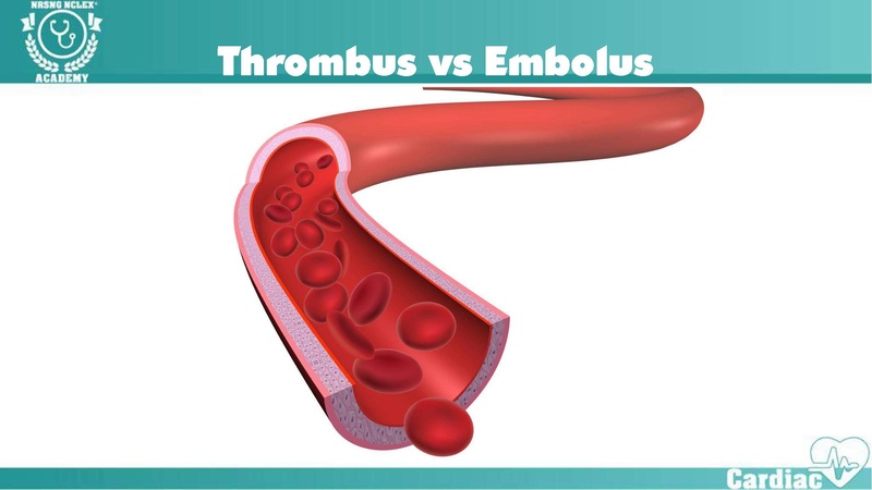 File:Thrombophlebitis – Virchow’s Triad.pdf