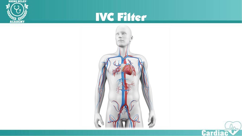 File:Thrombophlebitis – Virchow’s Triad.pdf