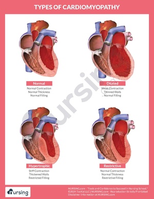 Types of Cardiomyopathy.pdf