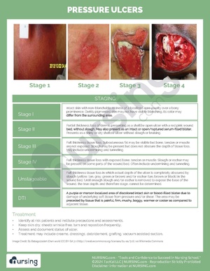 Pressure Ulcer Staging.pdf