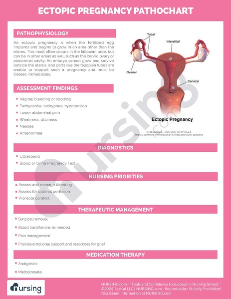 File:Ectopic Pregnancy Pathochart.pdf