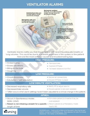 Ventilator Alarms.pdf
