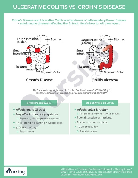 File:Ulcerative Colitis vs. Crohn’s Disease.pdf
