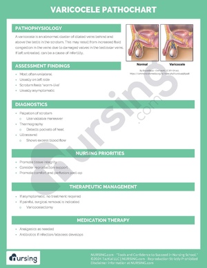 Varicocele Pathochart.pdf