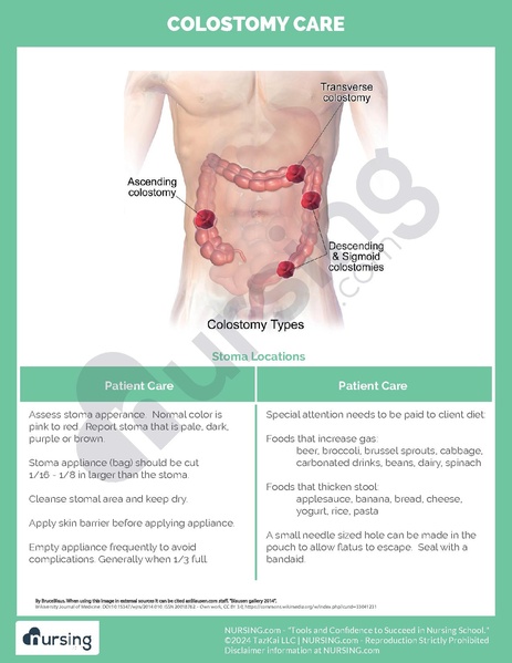 File:Colostomy Care Cheatsheet.pdf