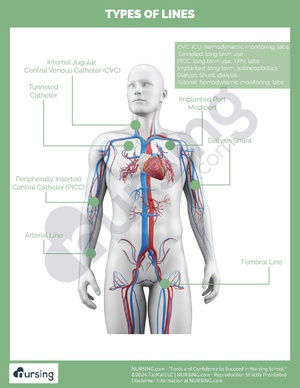 Central Lines.pdf
